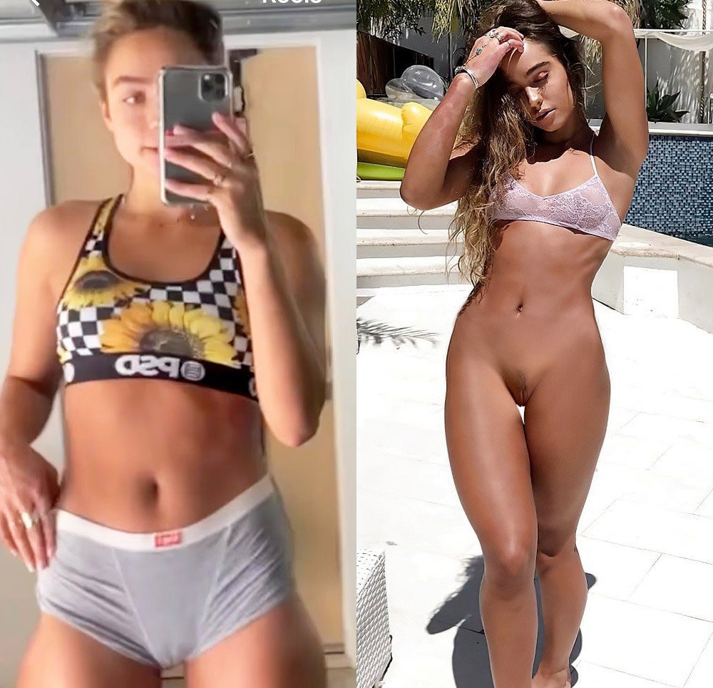 Sommer ray nudea